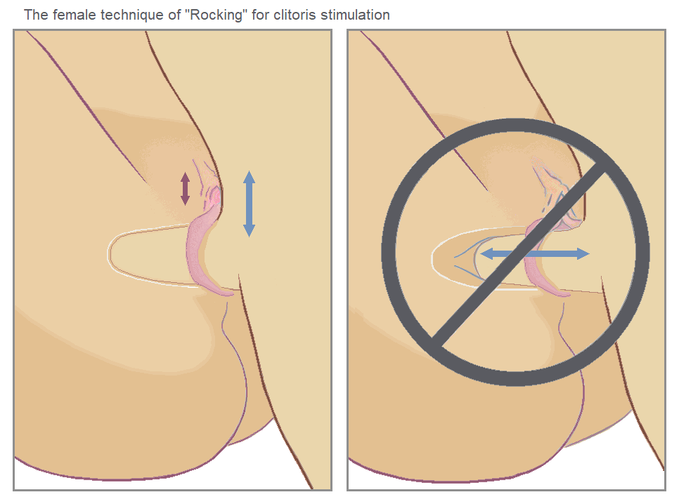 Vaginismus